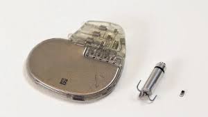 Aranybevonatú, személyre szabott pacemakert kapott egy beteg Pécsen, ami nemhogy az országban, a világon is ritkaság