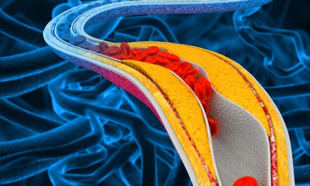 Itt az áttörés a koleszterinszint csökkentésében