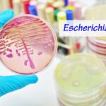 Ne edd meg, ha ilyet vettél az ALDI-ban: vastagbélgyulladást okozhat ez a konyhai alapanyag