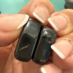 20 mágnest nyelt le egy gyerek, sebészt kellett hívni