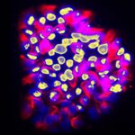 Meglepő pontossággal jelzi a rák terjedését ez az új fejlesztés