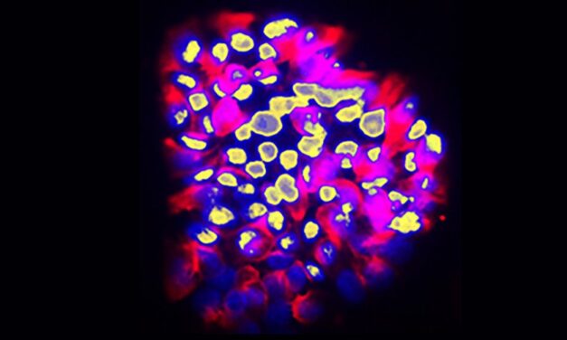Meglepő pontossággal jelzi a rák terjedését ez az új fejlesztés
