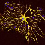 Megtalálták az agy kapcsolóját, ami leállítja az étvágyat