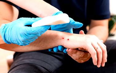 Saját udvarán mart meg egy nőt a Magyarországon honos kárpáti vipera: nagyot hibázott az áldozat